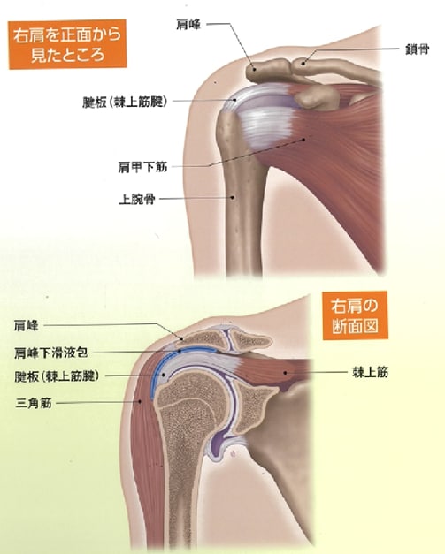 【肩腱板断裂】右肩